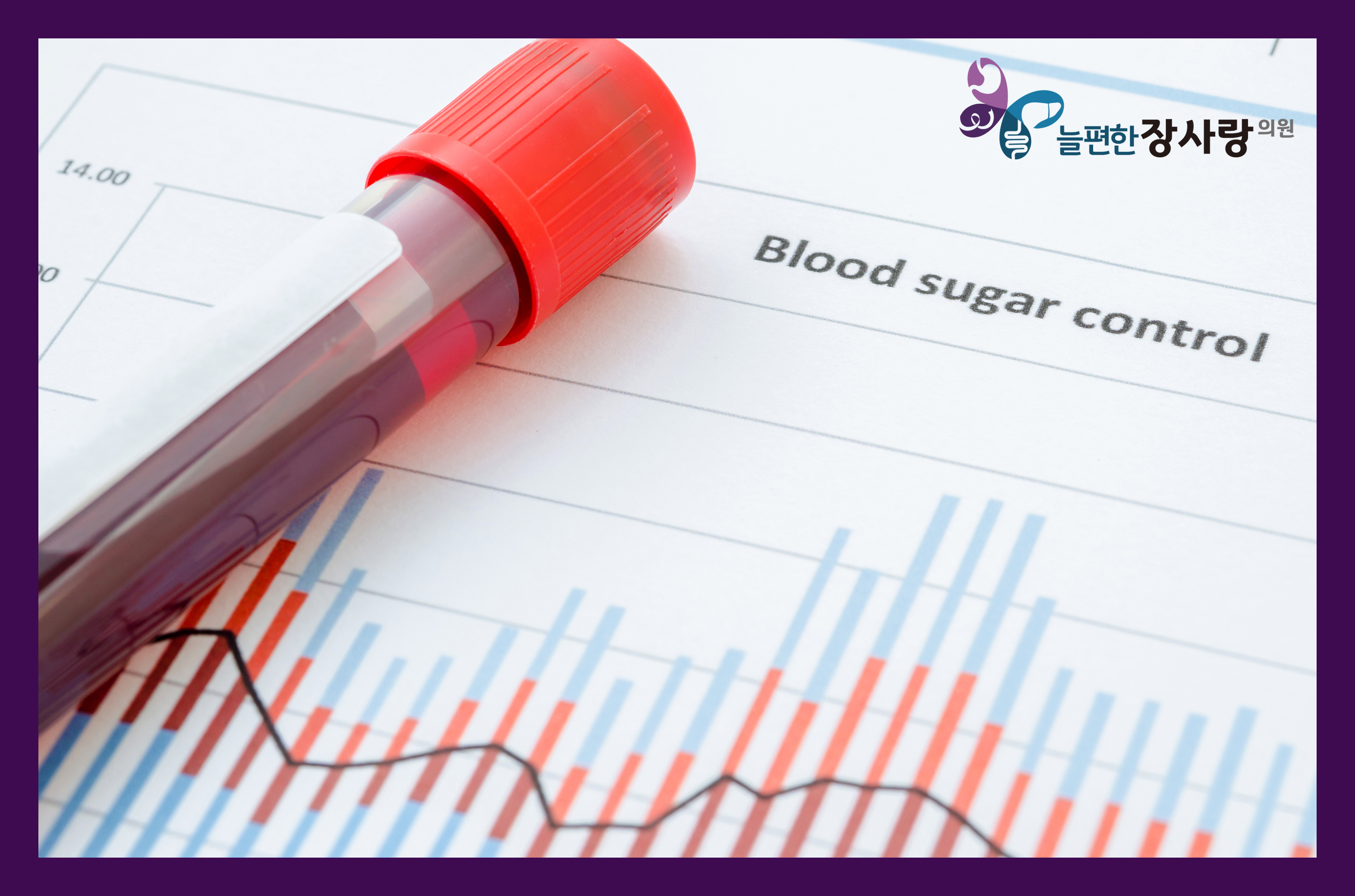 조기 진단의 중요성